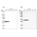 Atlas Antibodies Anti-RPS3A Antibody