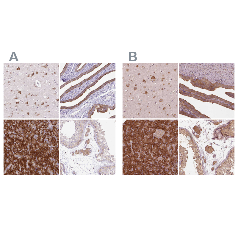 Atlas Antibodies Anti-RPS5 Antibody