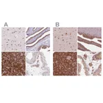 Atlas Antibodies Anti-RPS5 Antibody
