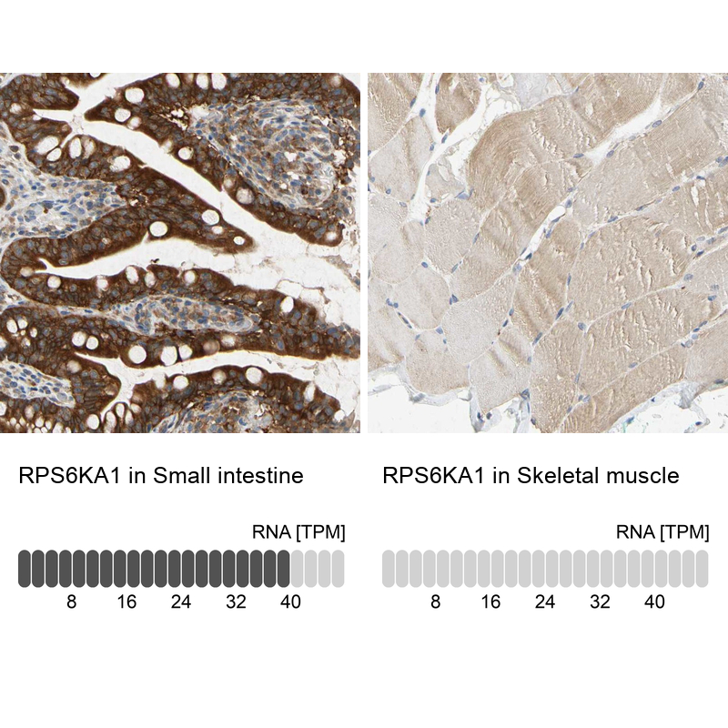 Atlas Antibodies Anti-RPS6KA1 Antibody