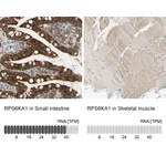 Atlas Antibodies Anti-RPS6KA1 Antibody