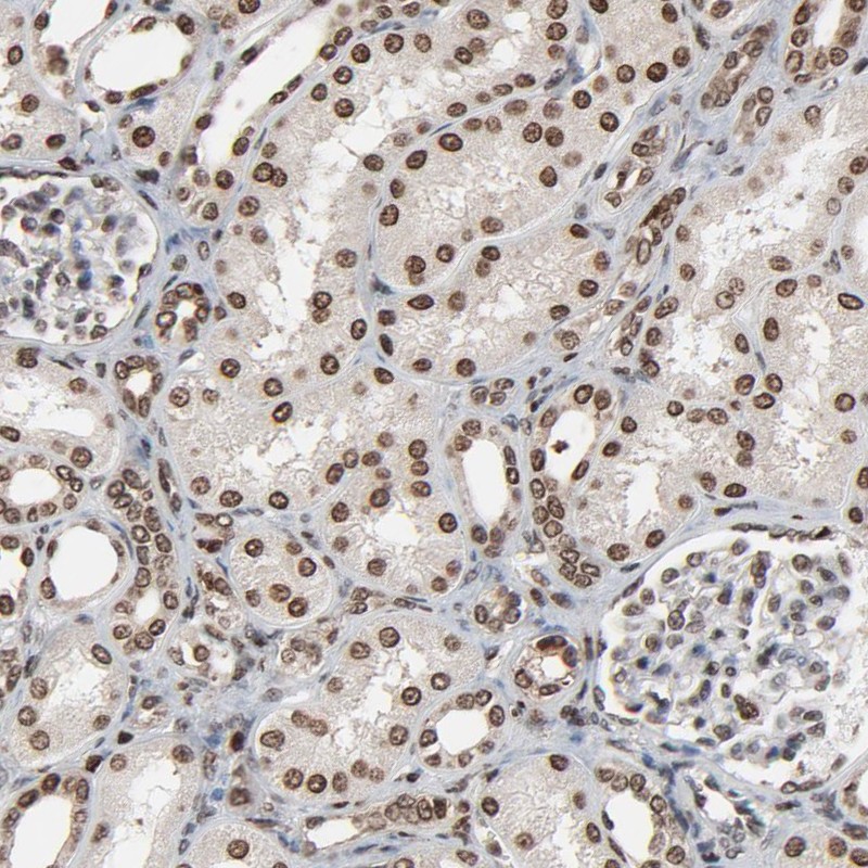 Atlas Antibodies Anti-RPS6KA3 Antibody