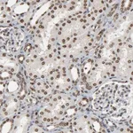 Atlas Antibodies Anti-RPS6KA3 Antibody