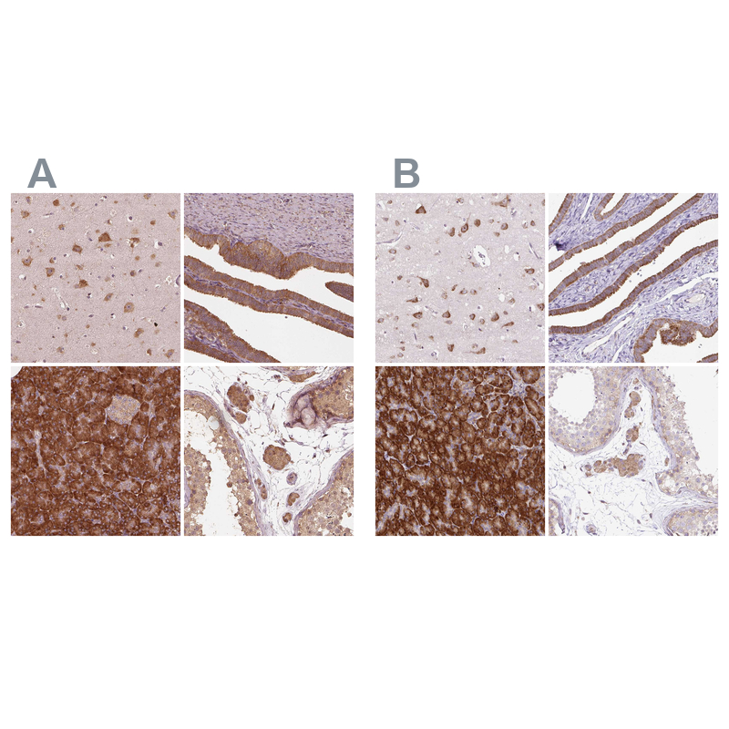 Atlas Antibodies Anti-RPS5 Antibody