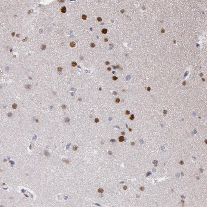 Atlas Antibodies Anti-RPS6KA5 Antibody