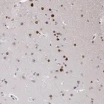 Atlas Antibodies Anti-RPS6KA5 Antibody