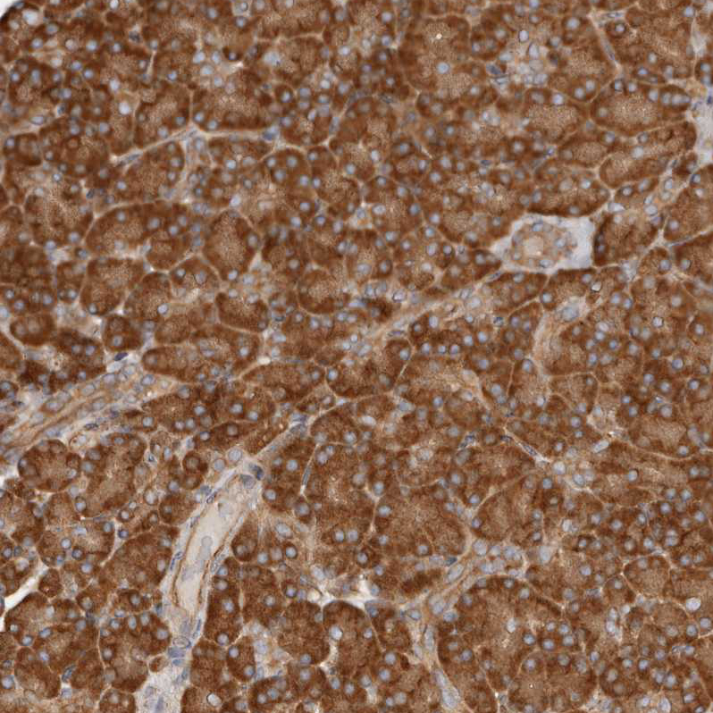Atlas Antibodies Anti-RPS6 Antibody