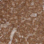 Atlas Antibodies Anti-RPS6 Antibody