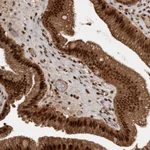 Atlas Antibodies Anti-RPS6KA4 Antibody