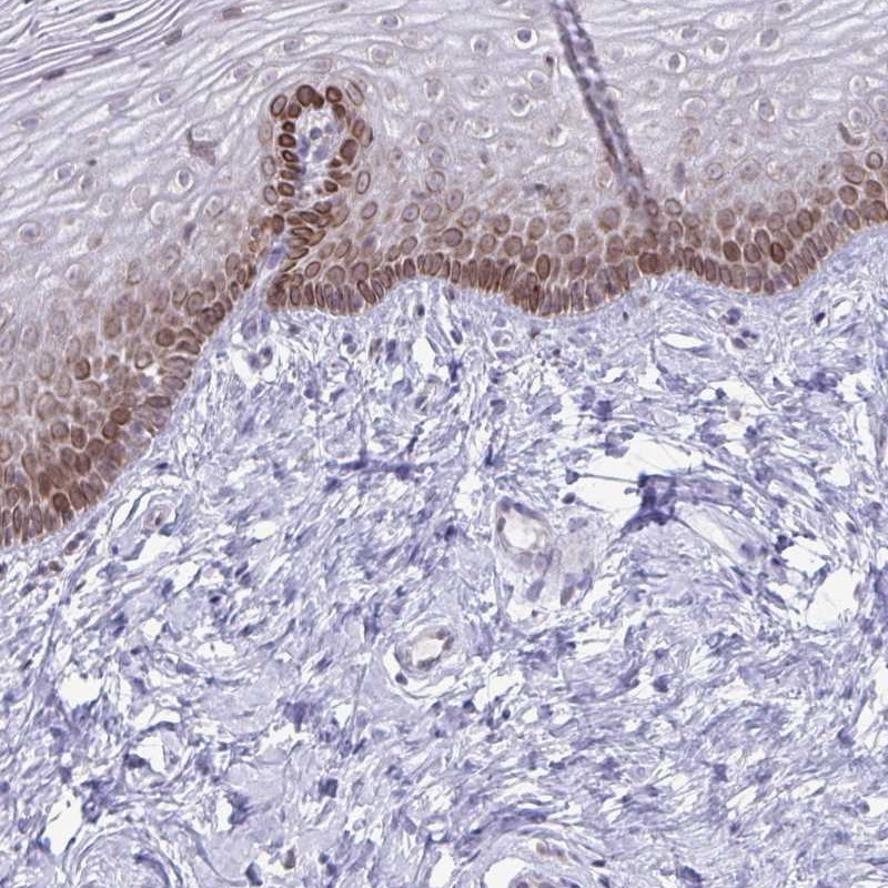 Atlas Antibodies Anti-RPS6KA2 Antibody
