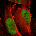 Atlas Antibodies Anti-RPS6KA5 Antibody