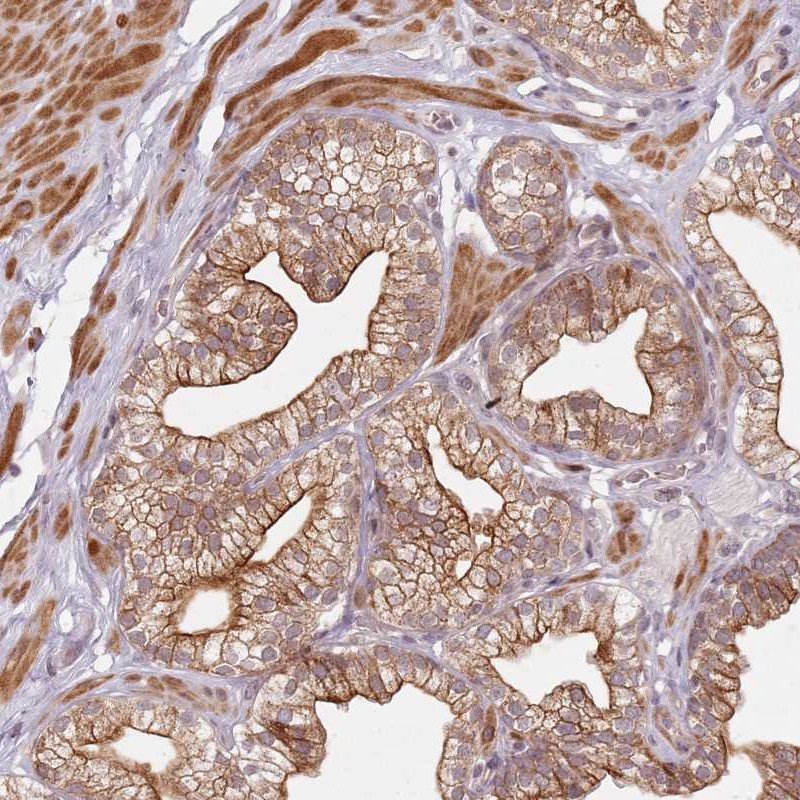 Atlas Antibodies Anti-RPS6KA2 Antibody