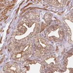Atlas Antibodies Anti-RPS6KA2 Antibody