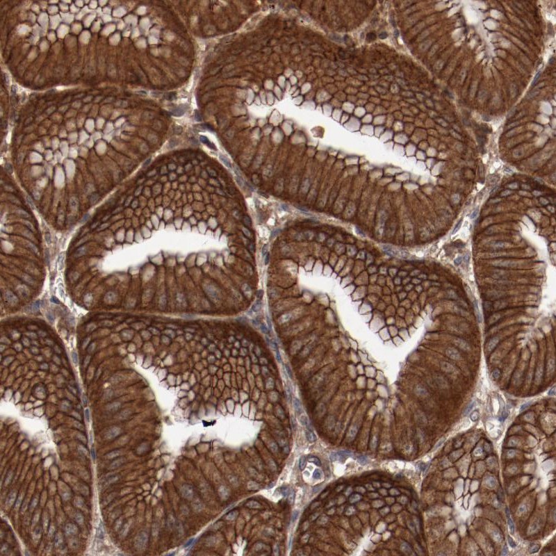 Atlas Antibodies Anti-RPS6KA6 Antibody