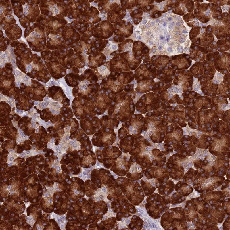 Atlas Antibodies Anti-RPS9 Antibody
