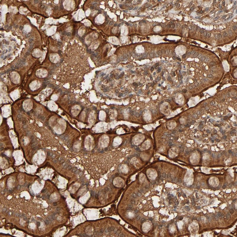 Atlas Antibodies Anti-RPS6KA6 Antibody