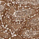 Atlas Antibodies Anti-RPS6KA6 Antibody