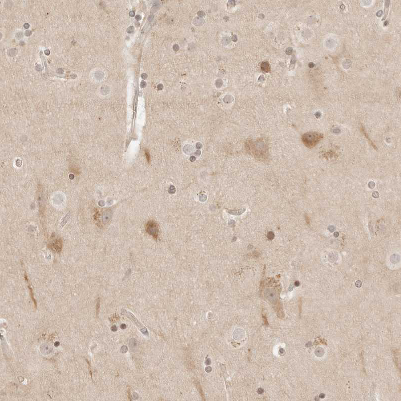 Atlas Antibodies Anti-RPS6KL1 Antibody