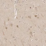 Atlas Antibodies Anti-RPS6KL1 Antibody