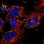 Atlas Antibodies Anti-RPS6KC1 Antibody