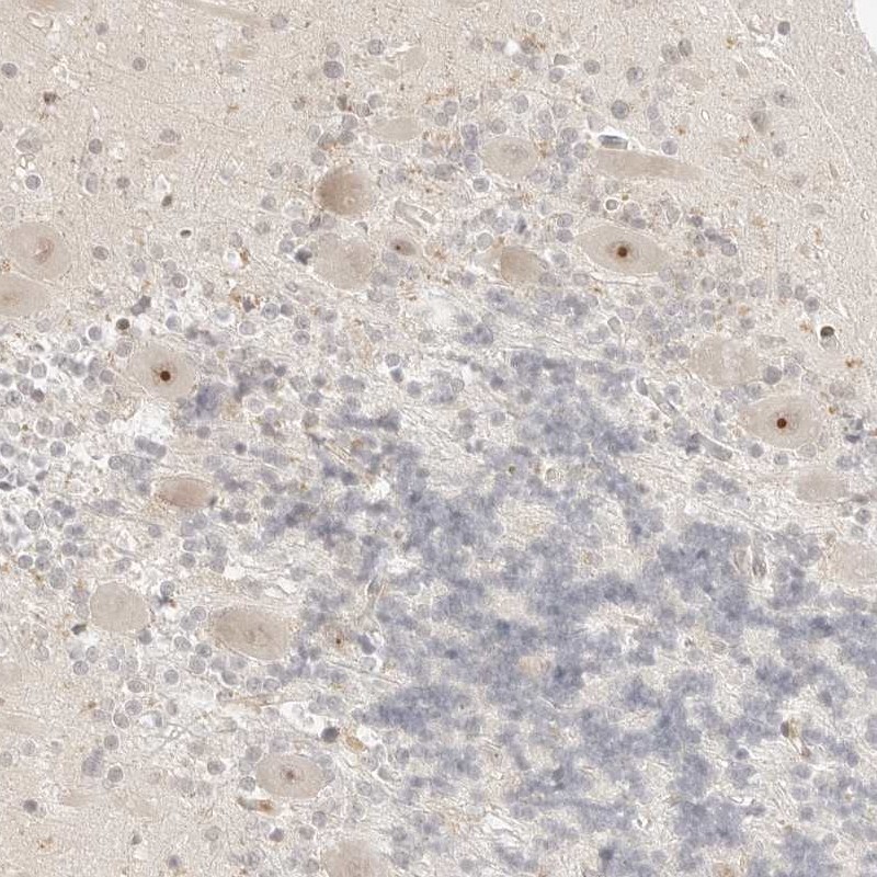 Atlas Antibodies Anti-RPS6KL1 Antibody