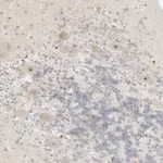 Atlas Antibodies Anti-RPS6KL1 Antibody