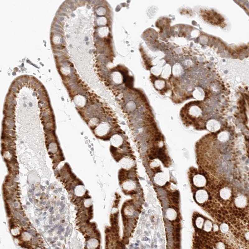 Atlas Antibodies Anti-RPS6KC1 Antibody