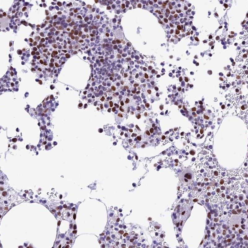 Atlas Antibodies Anti-RPS6KB1 Antibody