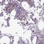 Atlas Antibodies Anti-RPS6KB1 Antibody