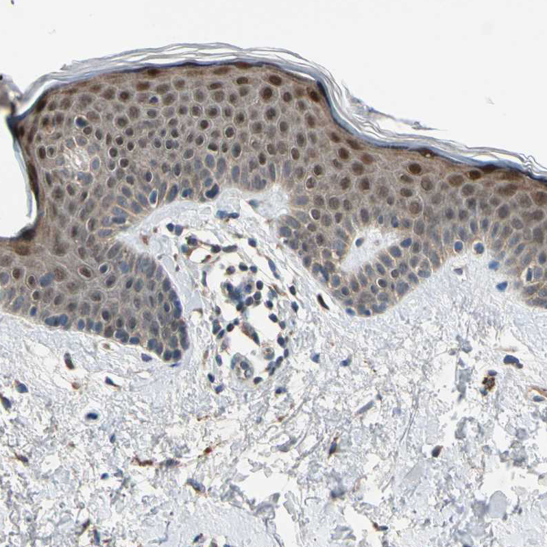 Atlas Antibodies Anti-RPS6KB2 Antibody