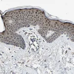 Atlas Antibodies Anti-RPS6KB2 Antibody