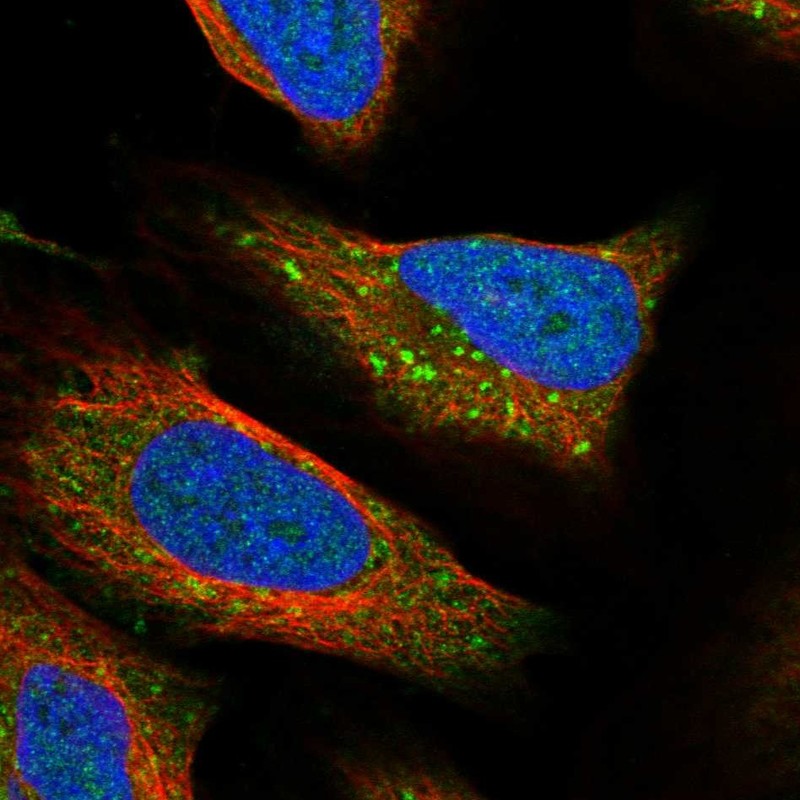 Atlas Antibodies Anti-RPTOR Antibody
