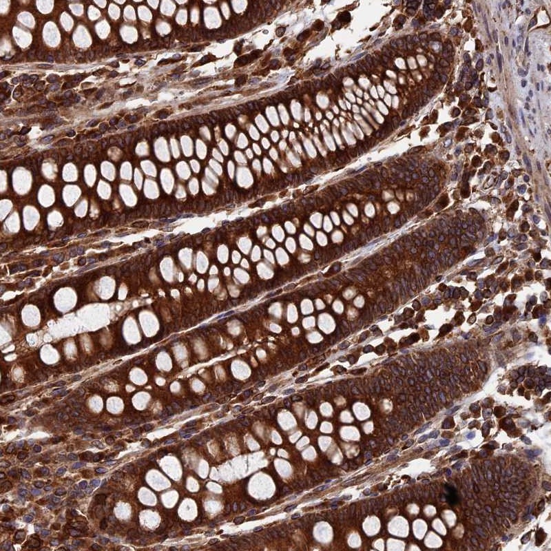Atlas Antibodies Anti-RPUSD1 Antibody