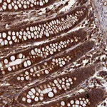 Atlas Antibodies Anti-RPUSD1 Antibody