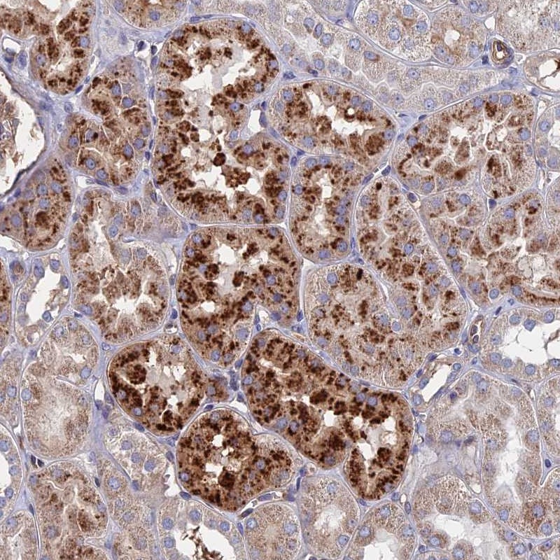 Atlas Antibodies Anti-RPUSD1 Antibody