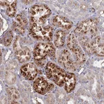 Atlas Antibodies Anti-RPUSD1 Antibody