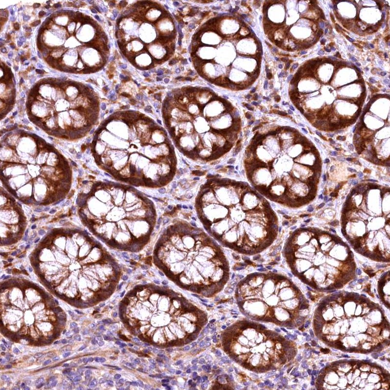 Atlas Antibodies Anti-RPUSD2 Antibody