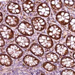 Atlas Antibodies Anti-RPUSD2 Antibody