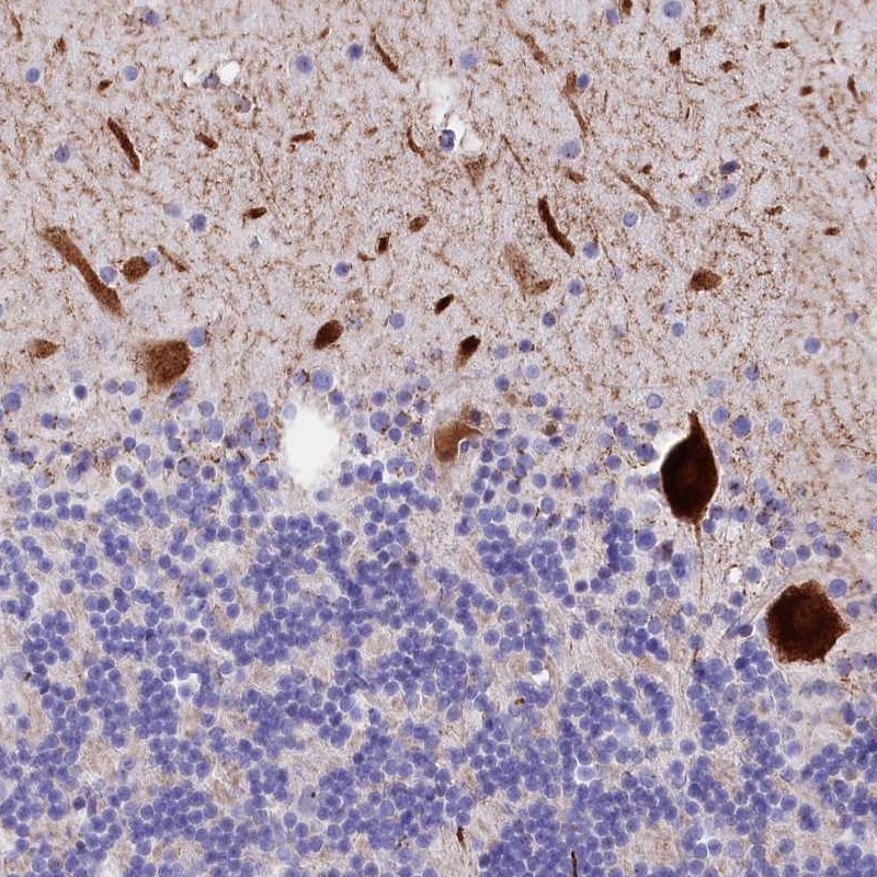 Atlas Antibodies Anti-RPUSD3 Antibody
