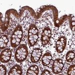 Atlas Antibodies Anti-RPUSD2 Antibody