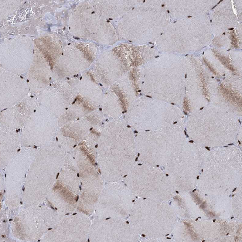 Atlas Antibodies Anti-RPUSD4 Antibody