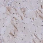 Atlas Antibodies Anti-RPUSD4 Antibody
