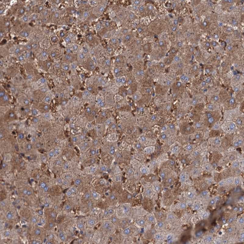 Atlas Antibodies Anti-RPUSD3 Antibody