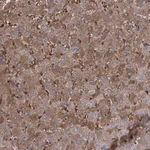 Atlas Antibodies Anti-RPUSD3 Antibody
