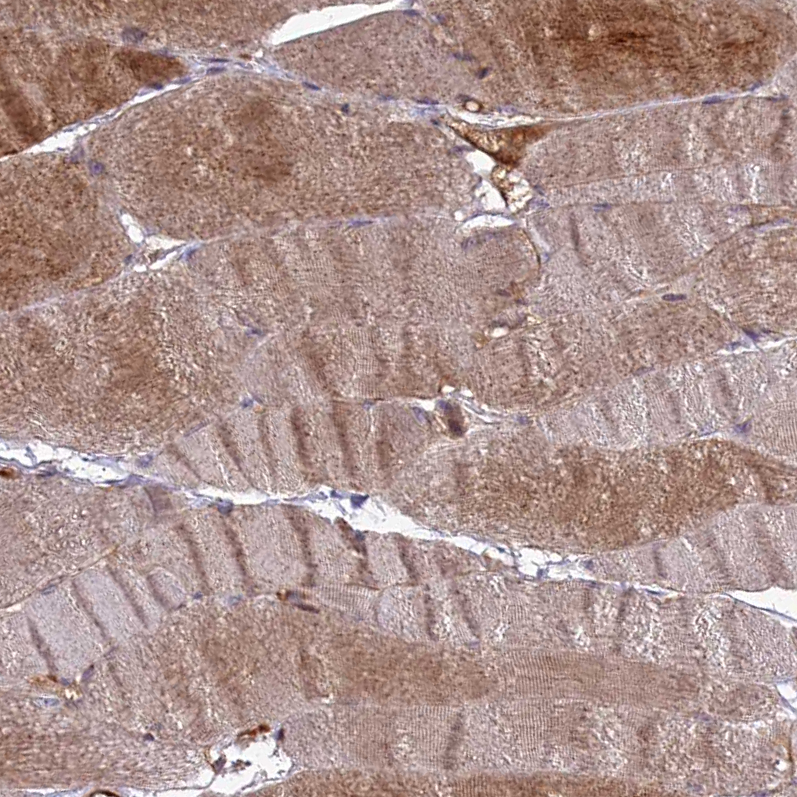 Atlas Antibodies Anti-RRAD Antibody