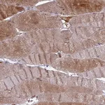 Atlas Antibodies Anti-RRAD Antibody