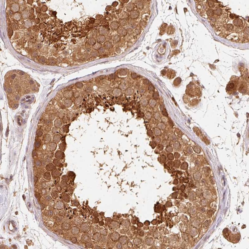 Atlas Antibodies Anti-RRAS2 Antibody