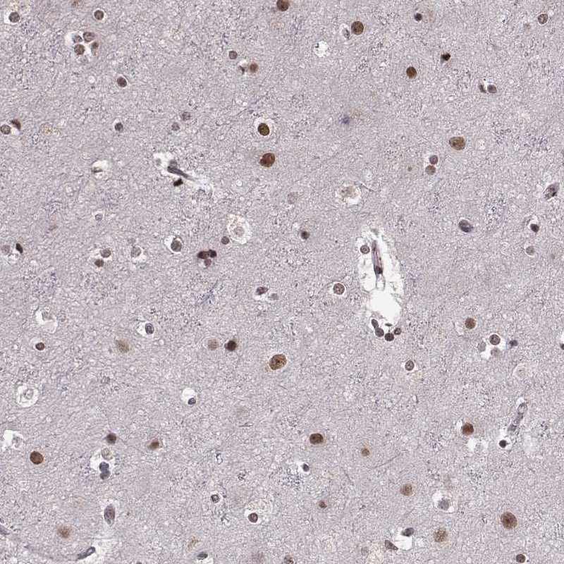 Atlas Antibodies Anti-RRAGD Antibody