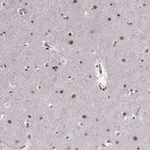 Atlas Antibodies Anti-RRAGD Antibody