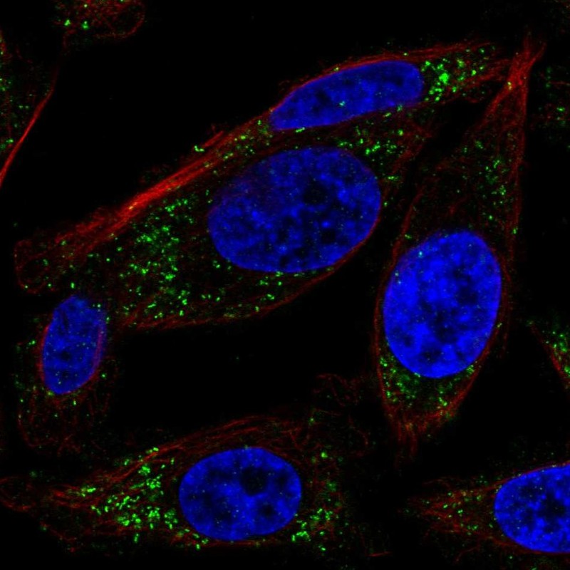 Atlas Antibodies Anti-RRAS Antibody